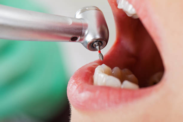 Best Emergency Tooth Extraction  in Montana City, MT